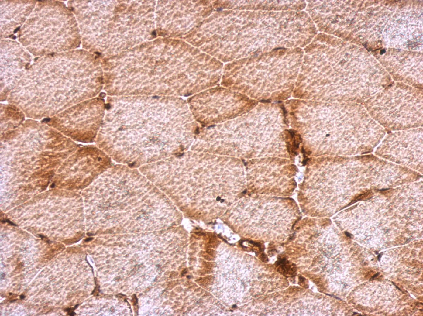 DENR / Density Regulated Antibody