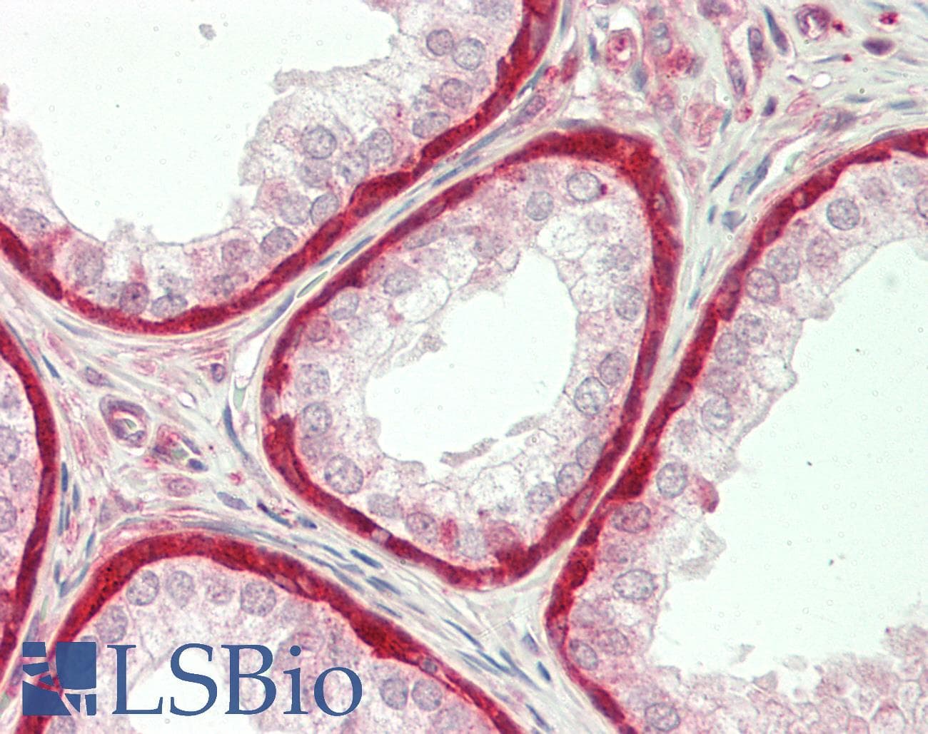 IHC-plus™ Monoclonal Mouse anti-Human GSTP1 / GST Pi Antibody (clone 10H1, IHC, WB)