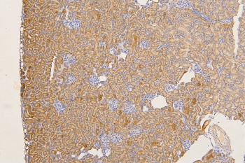 Polyclonal Rabbit anti-Human SFRP1 Antibody (IHC, WB)