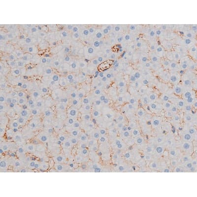 AKT1 Antibody (phospho-Ser124)