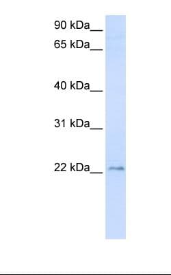 Polyclonal Rabbit anti-Human TMEM9 Antibody (C-Terminus, WB)