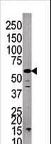 Polyclonal Rabbit anti-Human PPP3CC / CALNA3 Antibody (aa482-512, IHC, WB)