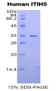 Human ITIH5 Protein (Recombinant His, N-Terminal)