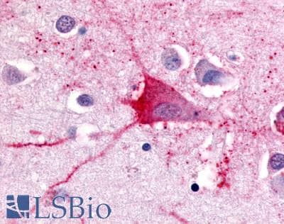 IHC-plus™ TRH Receptor / TRHR Antibody (Cytoplasmic Domain)