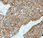 SYP / Synaptophysin Antibody