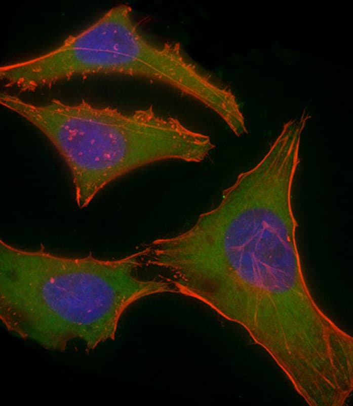 PLEC / Plectin Antibody (C-Terminus)