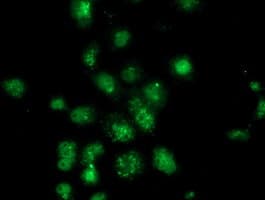 ANXA3 / Annexin A3 Antibody (clone OTI2F3)