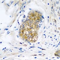 Polyclonal Rabbit anti-Human NLGN4Y Antibody (IHC, WB)