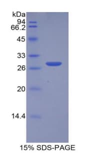 Human MPST Protein (Recombinant His-T7)