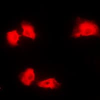 Polyclonal Rabbit anti-Human SLC4A1AP / Kanadaptin Antibody (Internal, IHC, IF, WB)