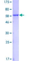Human AKR1C4 / Chlordecone Reductase Protein (Recombinant GST)