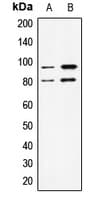 IHC-plus™ STAT1 Antibody (Internal)