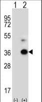 ANGPTL7 / CDT6 Antibody (aa315-346)