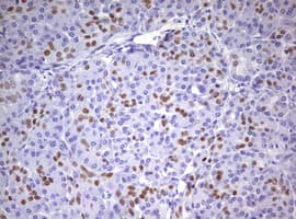 PR / Progesterone Receptor Antibody (aa1-298, clone OTI2F8)