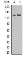 Polyclonal Rabbit anti-Human PR / Progesterone Receptor Antibody (Internal, IHC, IF, WB)