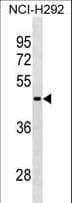 Polyclonal Rabbit anti-Human RBMY1A1 Antibody (aa468-496, WB)