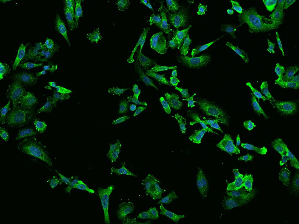 Polyclonal Rabbit anti-Human TPD52L2 / HD54 Antibody (IHC, IF, WB)