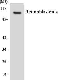 IHC-plus™ RB1 / Retinoblastoma / RB Antibody (aa196-245)