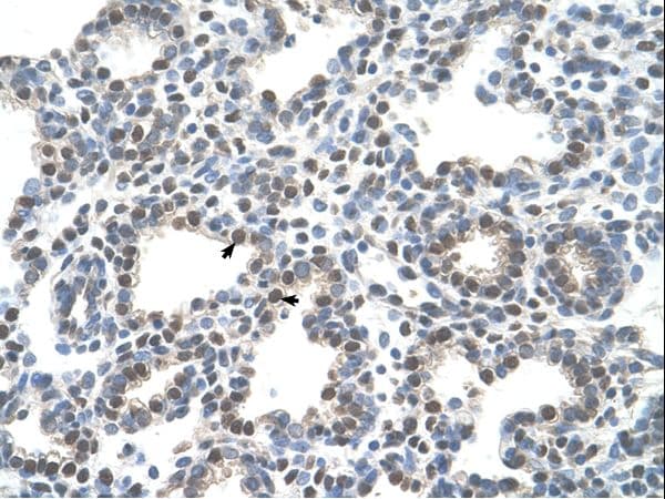 Polyclonal Rabbit anti-Human SLC10A5 Antibody (aa351-400, IHC, WB)