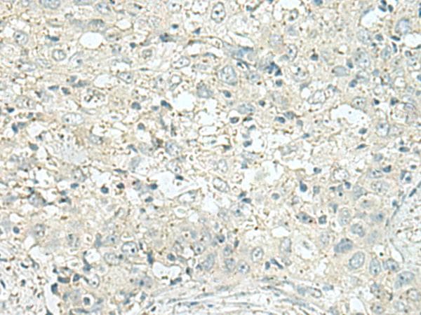 FAM116A Antibody
