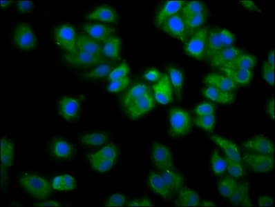 Polyclonal Rabbit anti-Human RAB21 Antibody (IHC, IF)