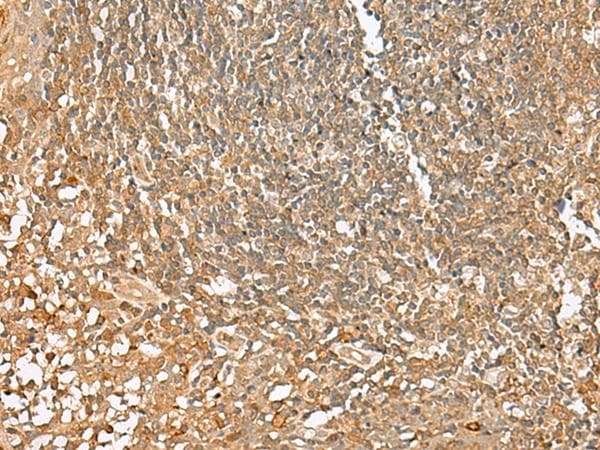 Polyclonal Rabbit anti-Human SCRN2 / Ses2 Antibody (IHC, WB)