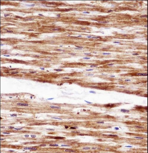RGS5 Antibody (aa24-53)