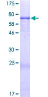 Human OXSM / KS Protein (Recombinant GST)