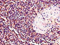 BTK Antibody