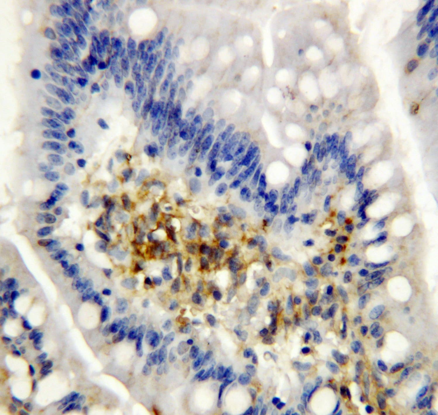 AIMP2 Antibody (aa298-320)