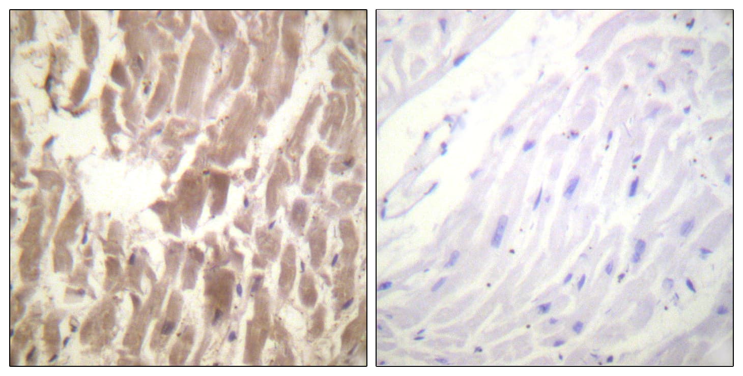 TNNI3 / Cardiac Troponin I Antibody (phospho-Ser43)