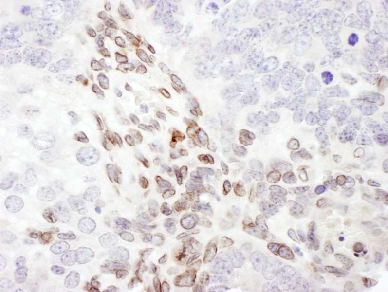Polyclonal Rabbit anti-Human LMNA / Lamin A+C Antibody (aa550-600, IHC, WB)