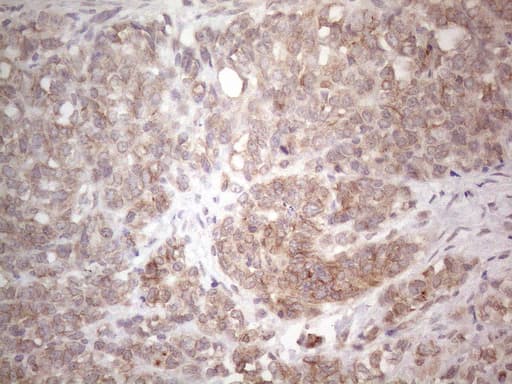 TLK2 Antibody (aa1-296, clone OTI2D10)