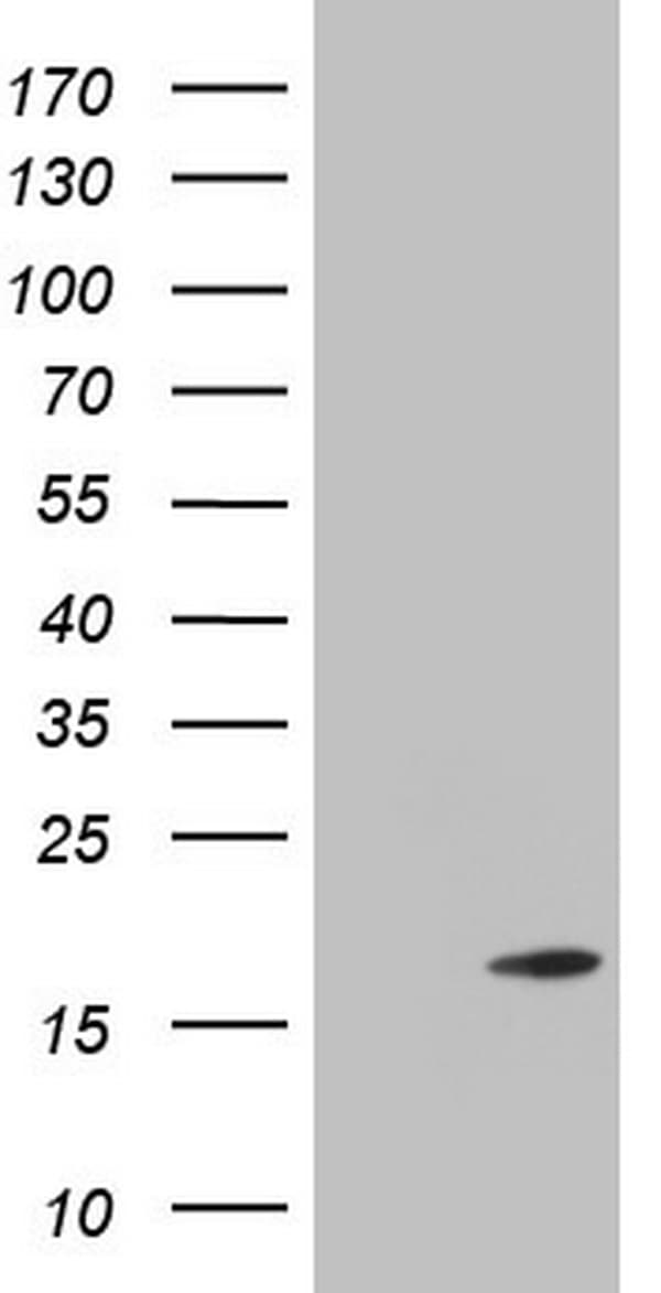 TWIST2 Antibody (clone OTI6H10)
