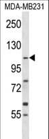 Polyclonal Rabbit anti-Human COPB1 / Beta-COP Antibody (aa351-380, WB)