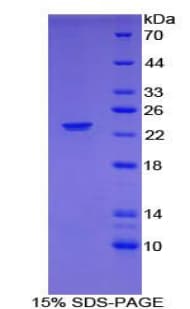 Mouse NCF2 / NOXA2 / p67phox Protein (Recombinant His-T7)