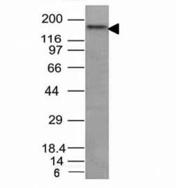 NCAM / CD56 Antibody (clone NCAM1/795)