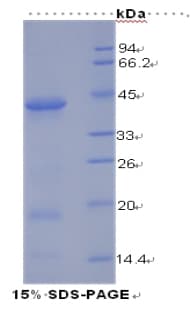 Human INSR / Insulin Receptor Protein (Recombinant His)