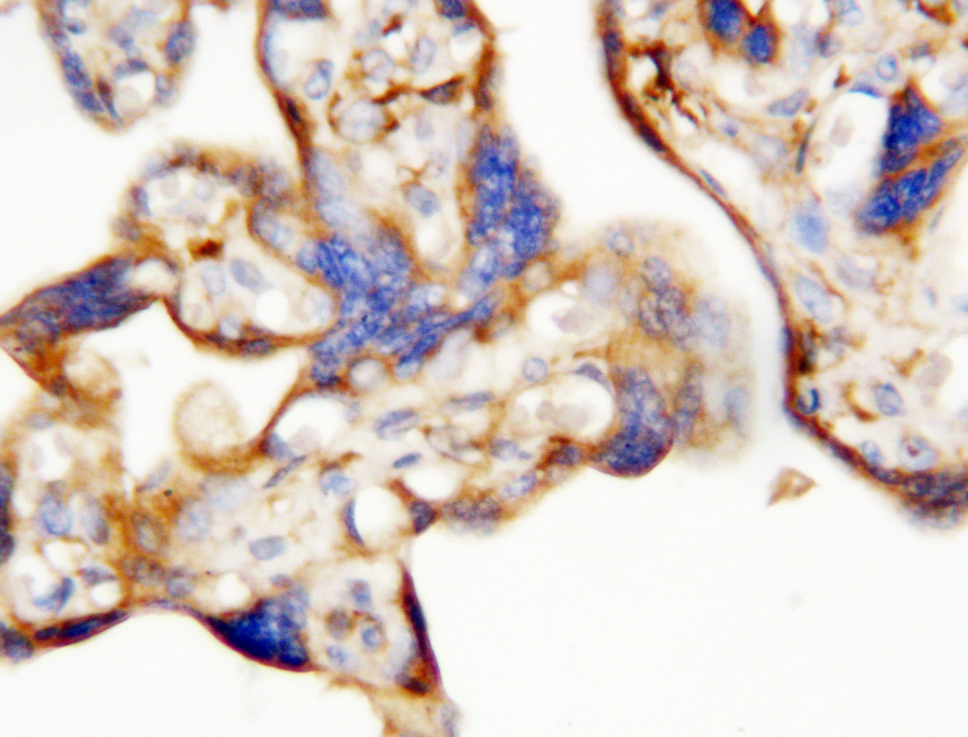 EPO / Erythropoietin Antibody (aa1-166)