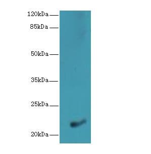 NKIRAS1 Antibody