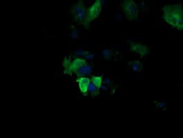 MAP2K1 / MKK1 / MEK1 Antibody (clone OTI2D2)