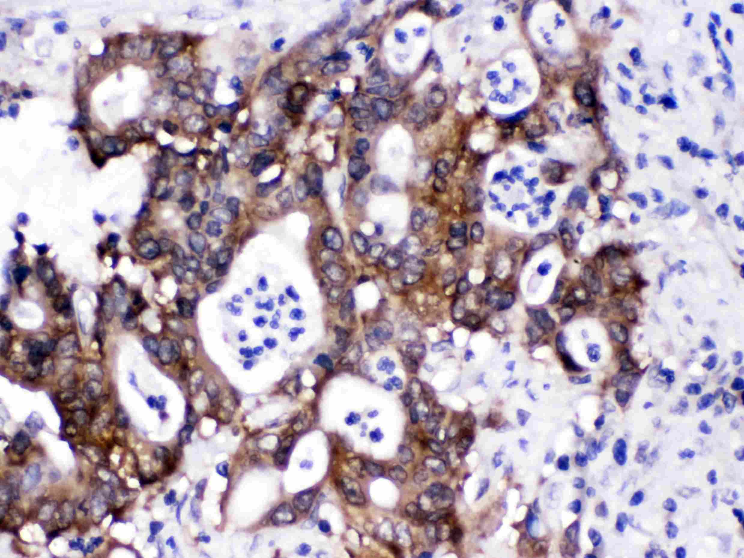 CACYBP Antibody