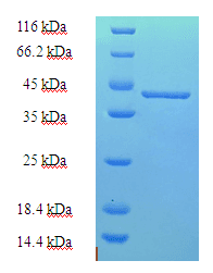 Human MIA40 / CHCHD4 Protein (Recombinant His-SUMO)