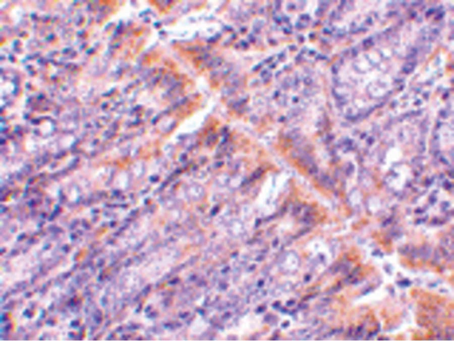 GOPC / PIST Antibody