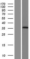AADACL3 Protein (Over-Expression Lysate Myc-DDK (Flag))