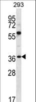 Polyclonal Rabbit anti-Human NPTN / SDR1 Antibody (aa188-216, WB)