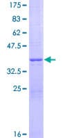 Human NDUFV3 Protein (Recombinant GST)