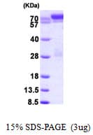 Human STAT1 Protein (Recombinant His)