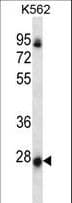 Polyclonal Rabbit anti-Human NRSN2 Antibody (aa128-157, IHC, WB)