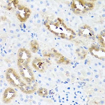 E-FABP / FABP5 Antibody
